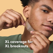 Hero Mighty Patch Surface - Extra Large Hydrocolloid Acne Patches - 10 Count