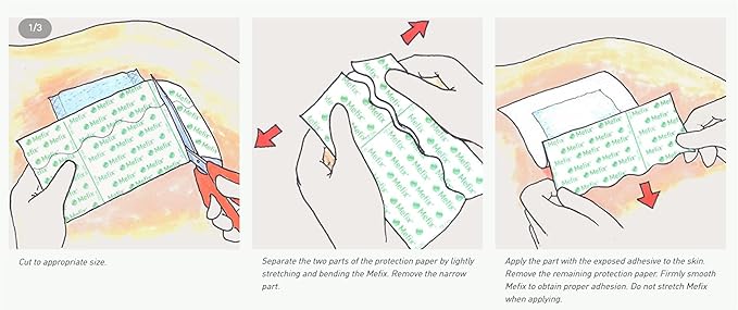 Mefix Medical Adhesive Soft Cloth Tape Roll, 5 cm x 10 m, on how to use