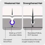 Sons Minoxidil 5% Solution 3x60ml & Dermaroller Kit for Men