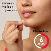 Hero Mighty Patch Original - Night Time Hydrocolloid Acne Patches - 24 Count